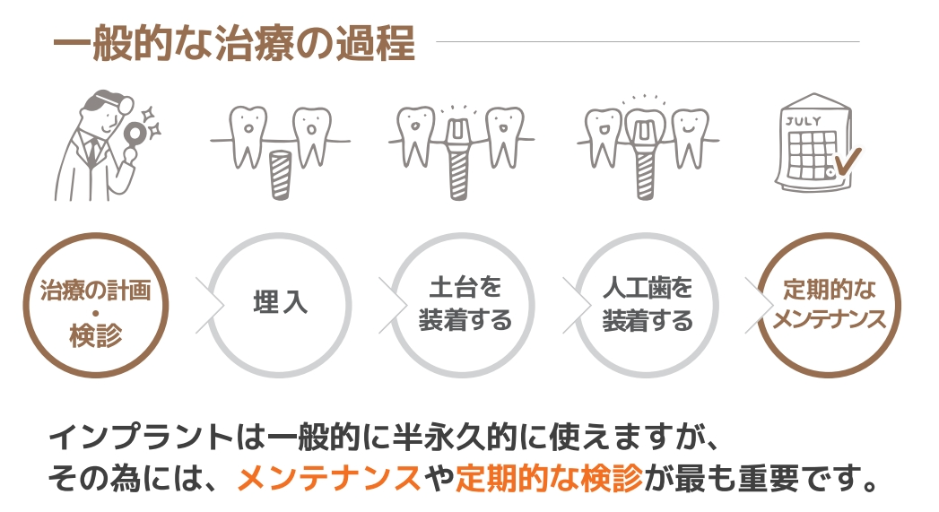 一般的な治療の過程